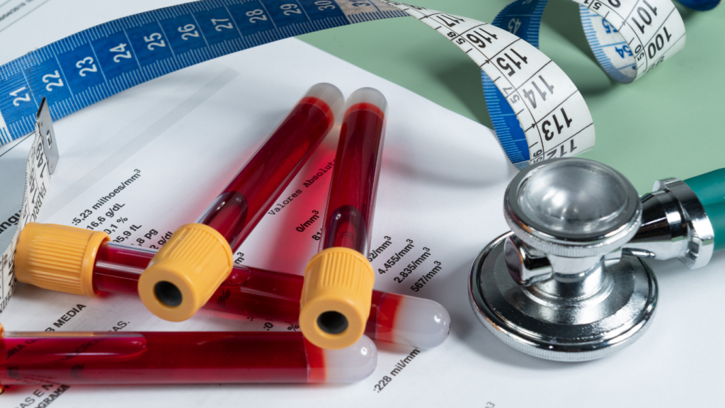 Blood test vials, stethoscope, and tape measure on lab report—symbolising diagnostic testing for metabolic health, cardiovascular risk, and longevity assessment.